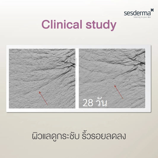 RETIAGE Liposomal Serum