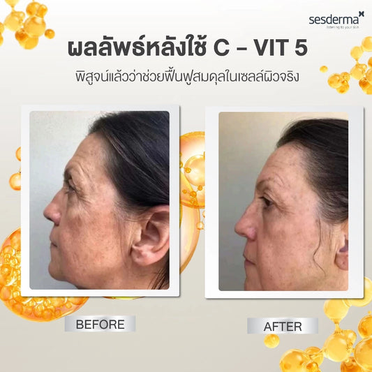 C-VIT 5 Liposomal Serum